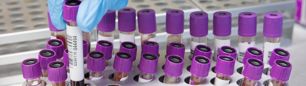 blood, sample, lab-4944424.jpg